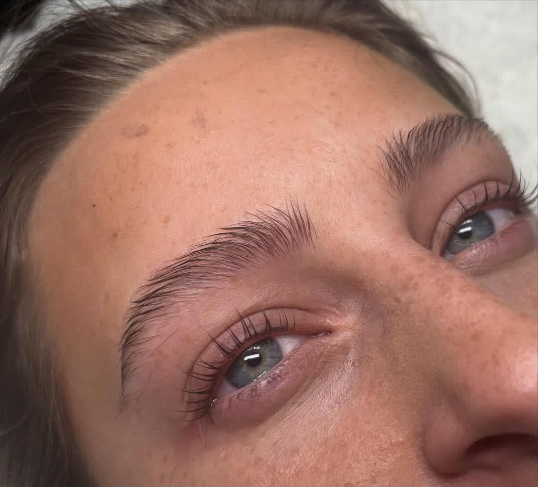 After treatment